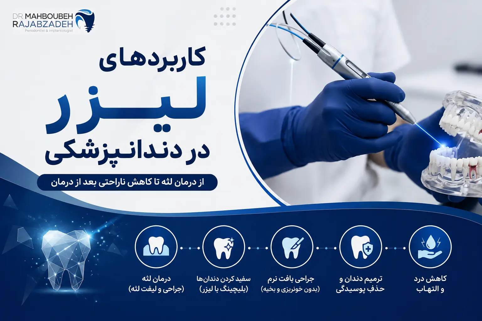 لیزر دندانپزشکی چیست و چه کاربردی دارد؟ از درمان لثه تا کاهش ناراحتی
